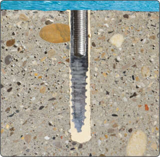 DOUILLE INOX A4 À LA RÉSINE vue en coupe